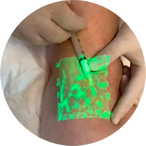 Equipamento VeinViewer de Realidade Aumentada